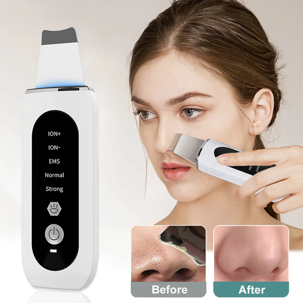 Ultrasonic Beauty Device