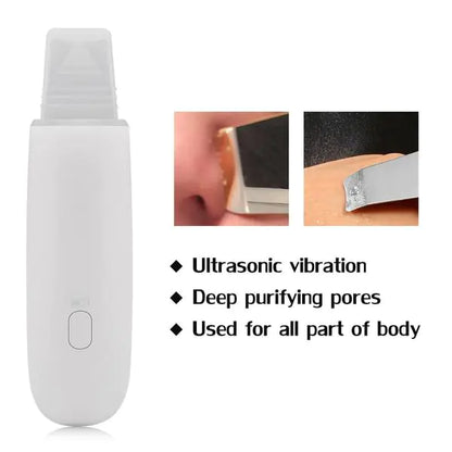 Skin Exfoliator and Cleansing Beauty Device